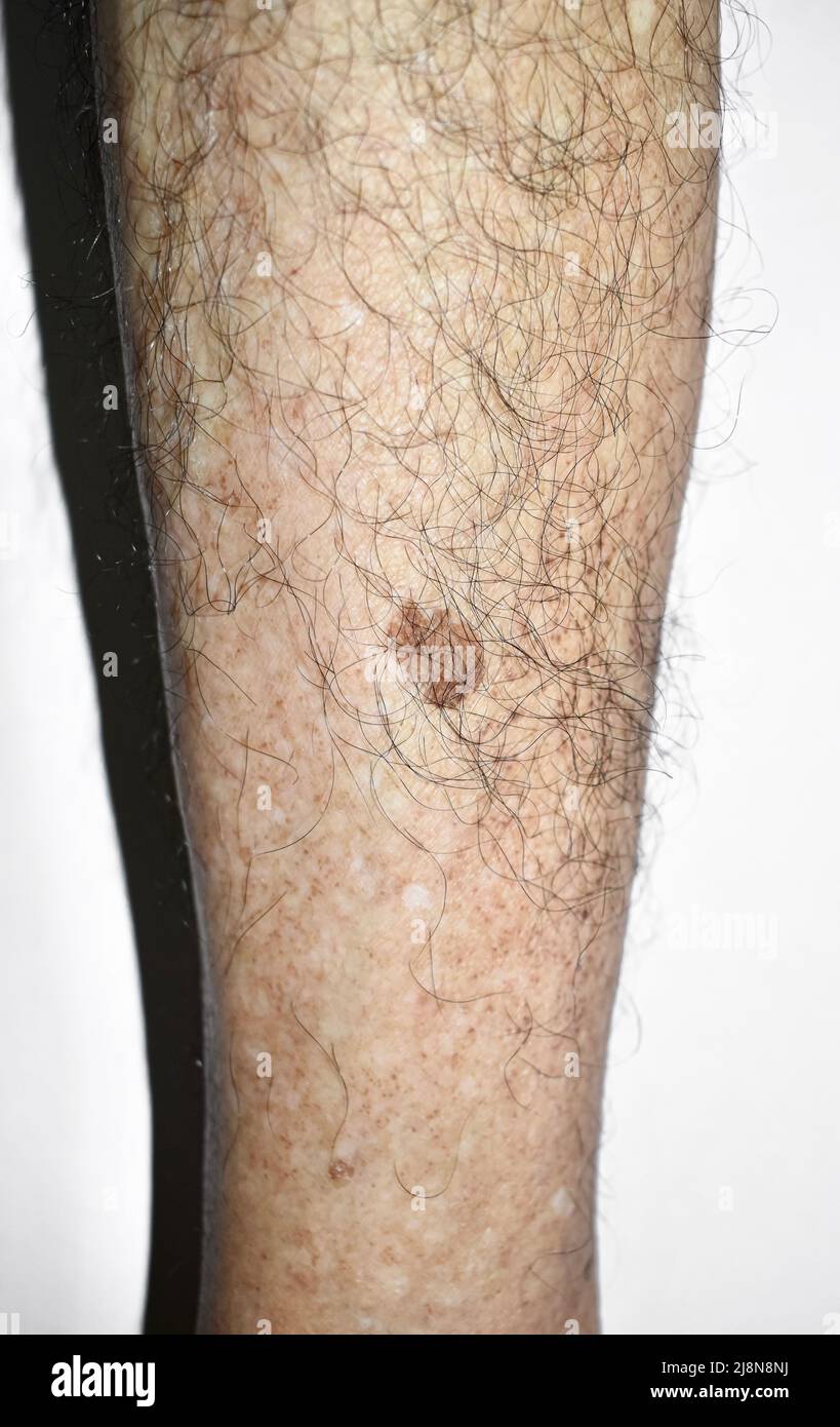 Zahlreiche schwarze flecken -Fotos und -Bildmaterial in hoher Auflösung ...