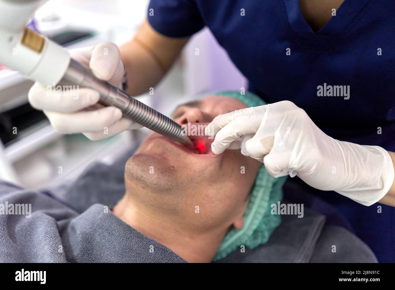 Arzt, der die Lippe eines Mannes für eine intraorale Laser-Schönheitsbehandlung auseinanderzieht Stockfoto