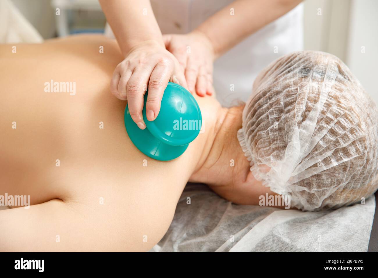 Vakuummassage. Vakuumbecher mit medizinischer Schröpftherapie auf dem Rücken der Frau, Nahaufnahme, chinesische Medizin. Stockfoto