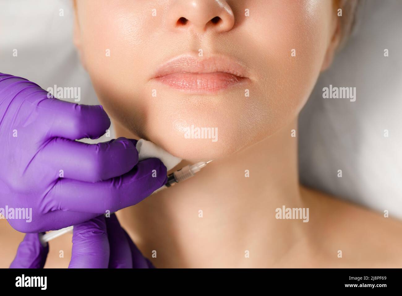 Ein Kosmetologe führt ein Verfahren zur Korrektur der Form des Kinns einer Frau durch. Injektionen in das Kinn. Stockfoto