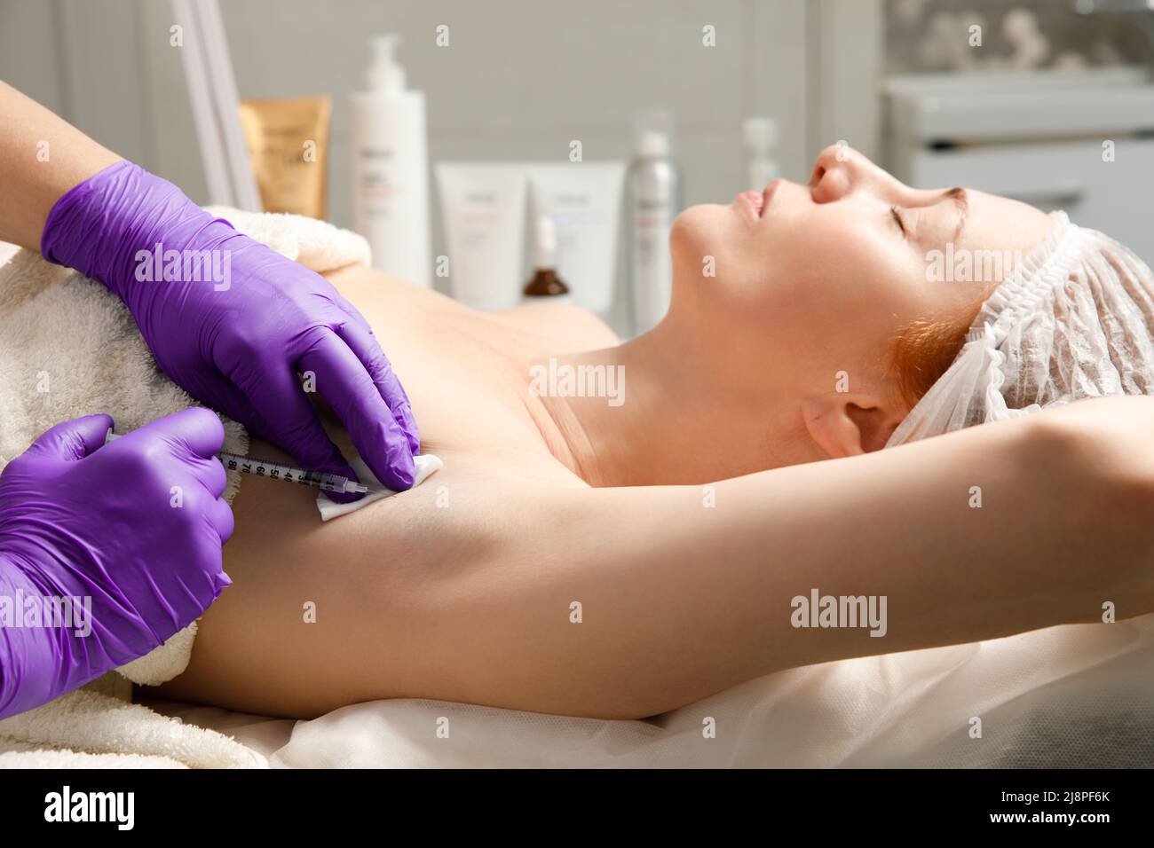 Behandlung der Achselhöhle gegen Hyperhidrose. Kosmetische Injektion Verfahren. Klinik Kosmetologie Schweißtherapie. Schönheit junge Frau. Hautpflege für Mädchen. Stockfoto