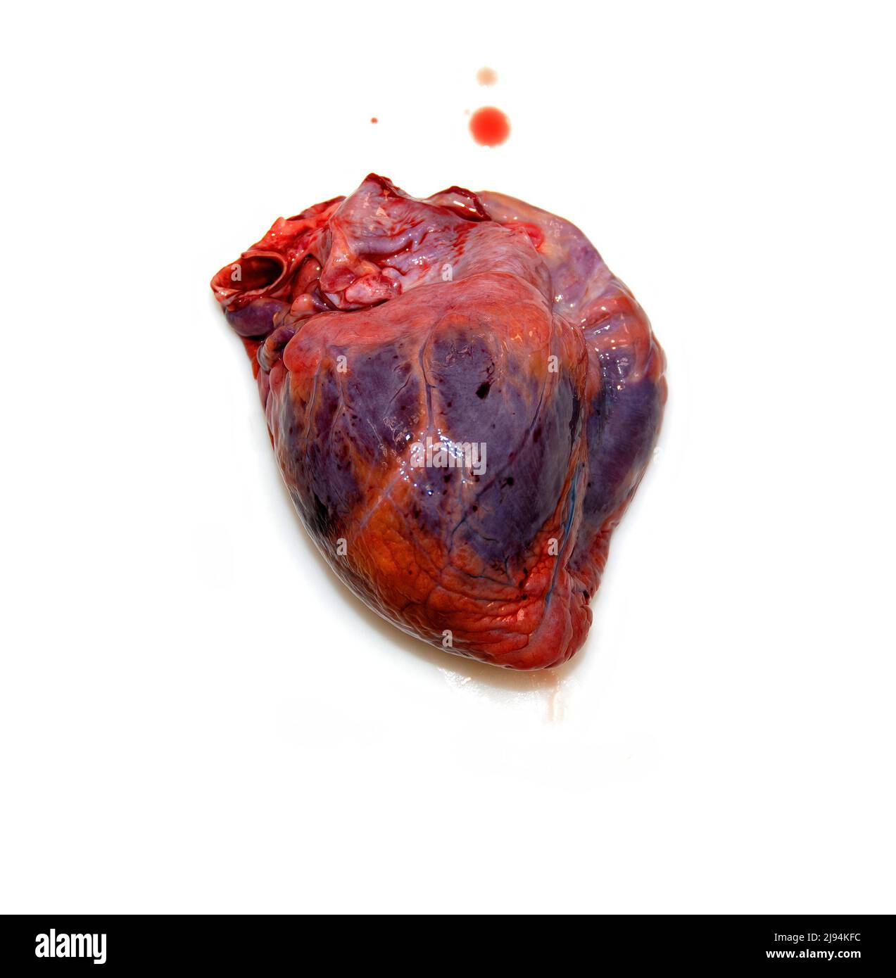 Ein isoliertes Herz auf weißem Hintergrund mit Symptomen von Herzleiden neben einem Tropfen Blut Stockfoto