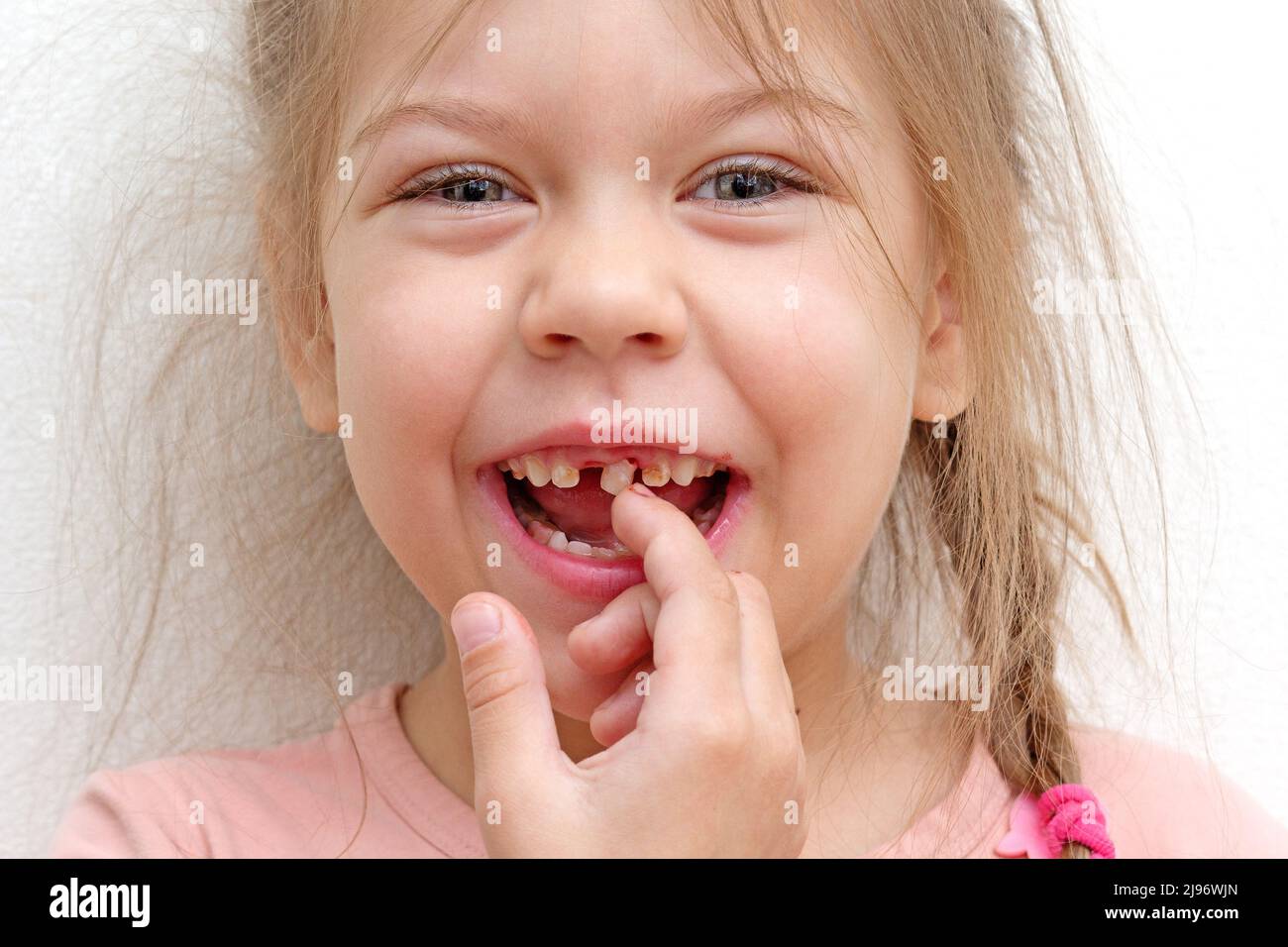 Glückliches und lächelndes kaukasisches kleines Mädchen von 5-6 Jahren, das mit dem Finger lose Zähne berührt und die Kamera anschaut Stockfoto
