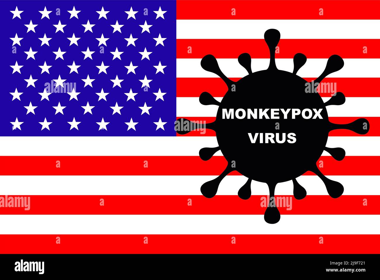 MONKEYPOXVIRUS. Flagge der USA. Monkeypox Spanien. Zoonotische