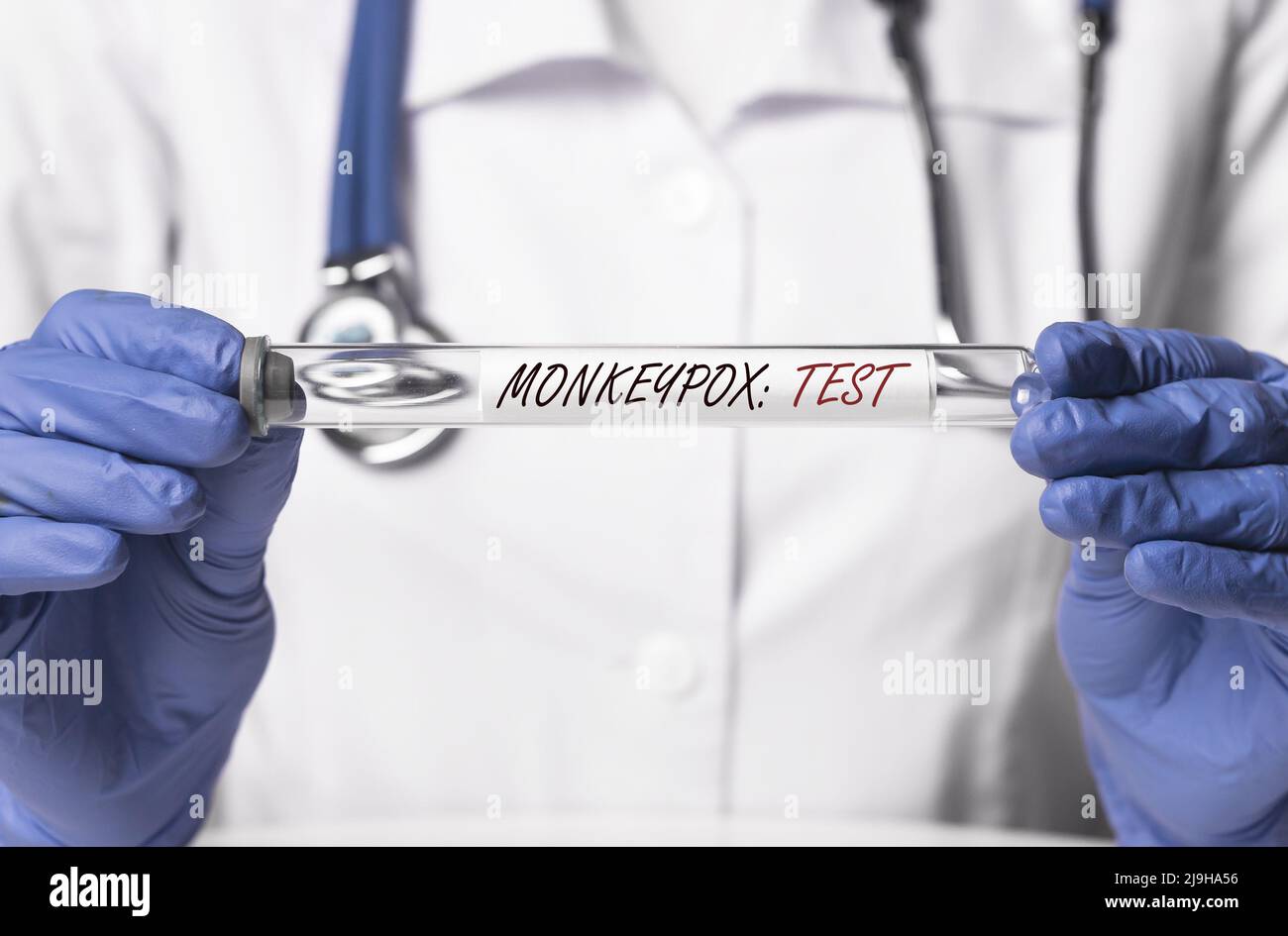 Testkonzept für Monkeypox-Viren. Doctor Hände mit Glasrohr. Stockfoto