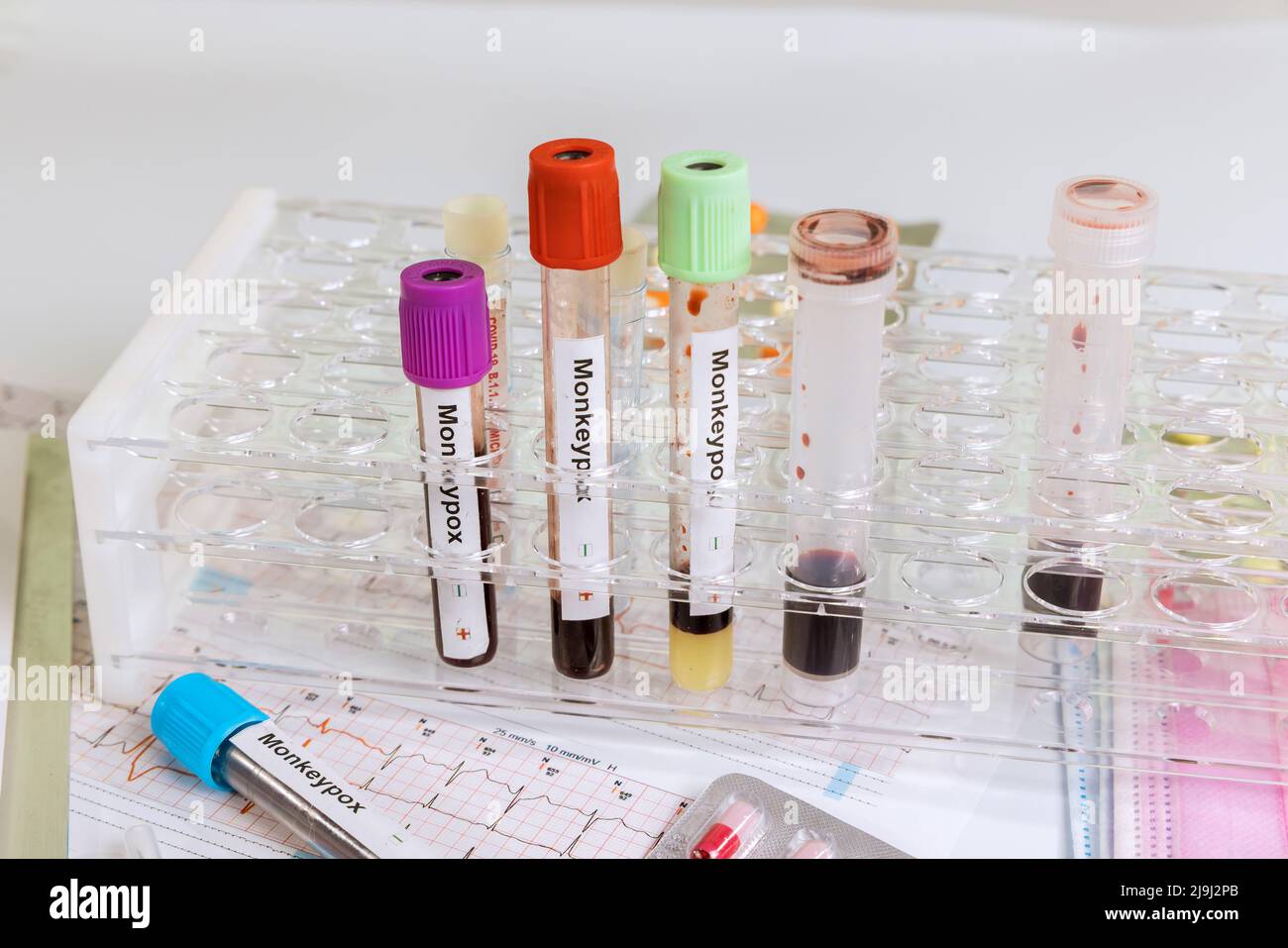 Labor in Check-up-Analyse Bluttest für Pocken Monkey Infektion Bluttest Stockfoto