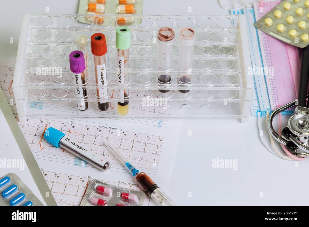 Monkeypox-Virus-Infektion Blutprobe Test mit Pillen, Tabletten Blutprobe im Labor Stockfoto