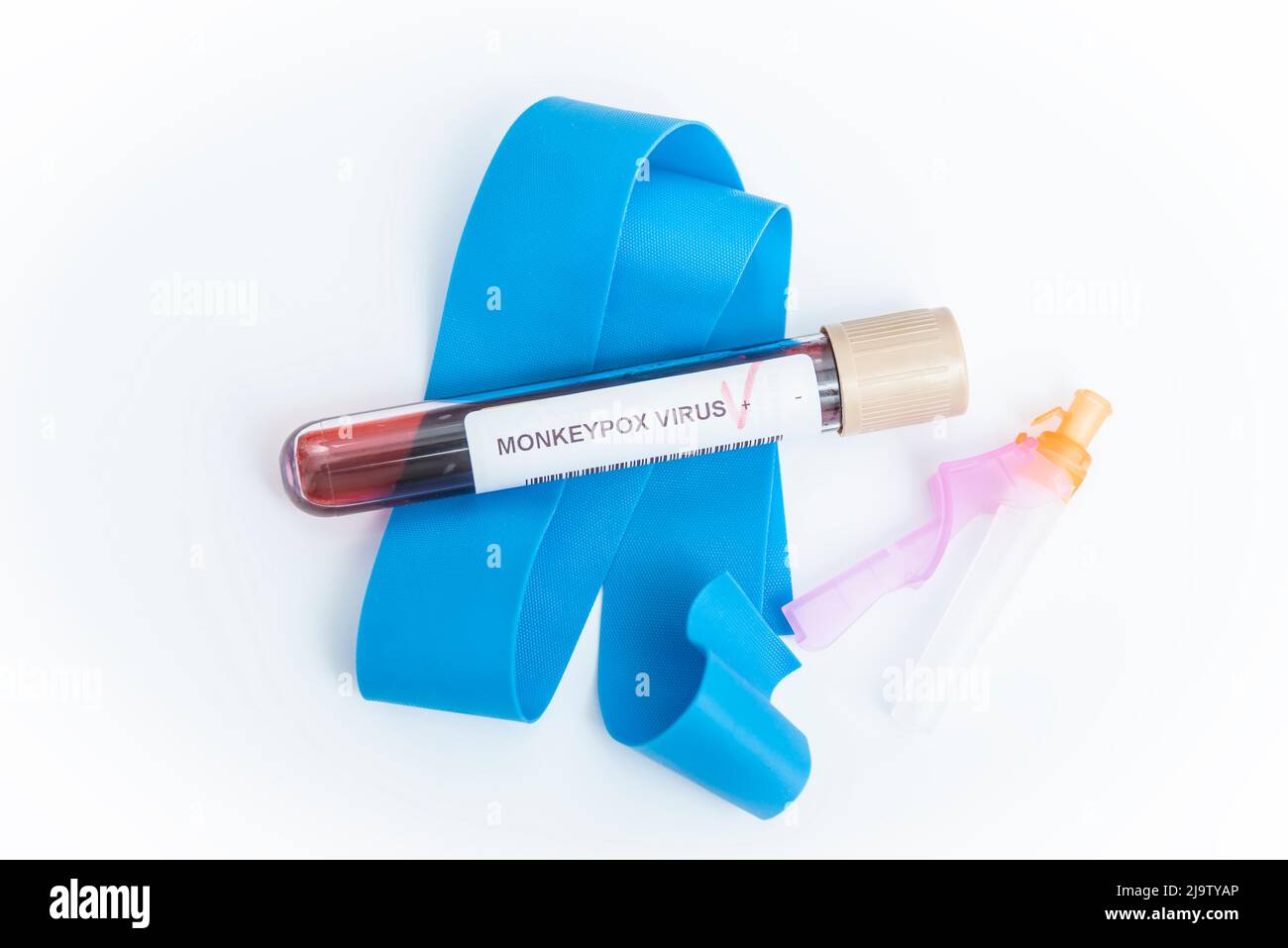 Monkeypox-Virus-Konzept: Wissenschaftler, der mit dem Monkeypox-Virus infiziertes Blut in einem Reagenzglas auf weißem Hintergrund hält. Stockfoto