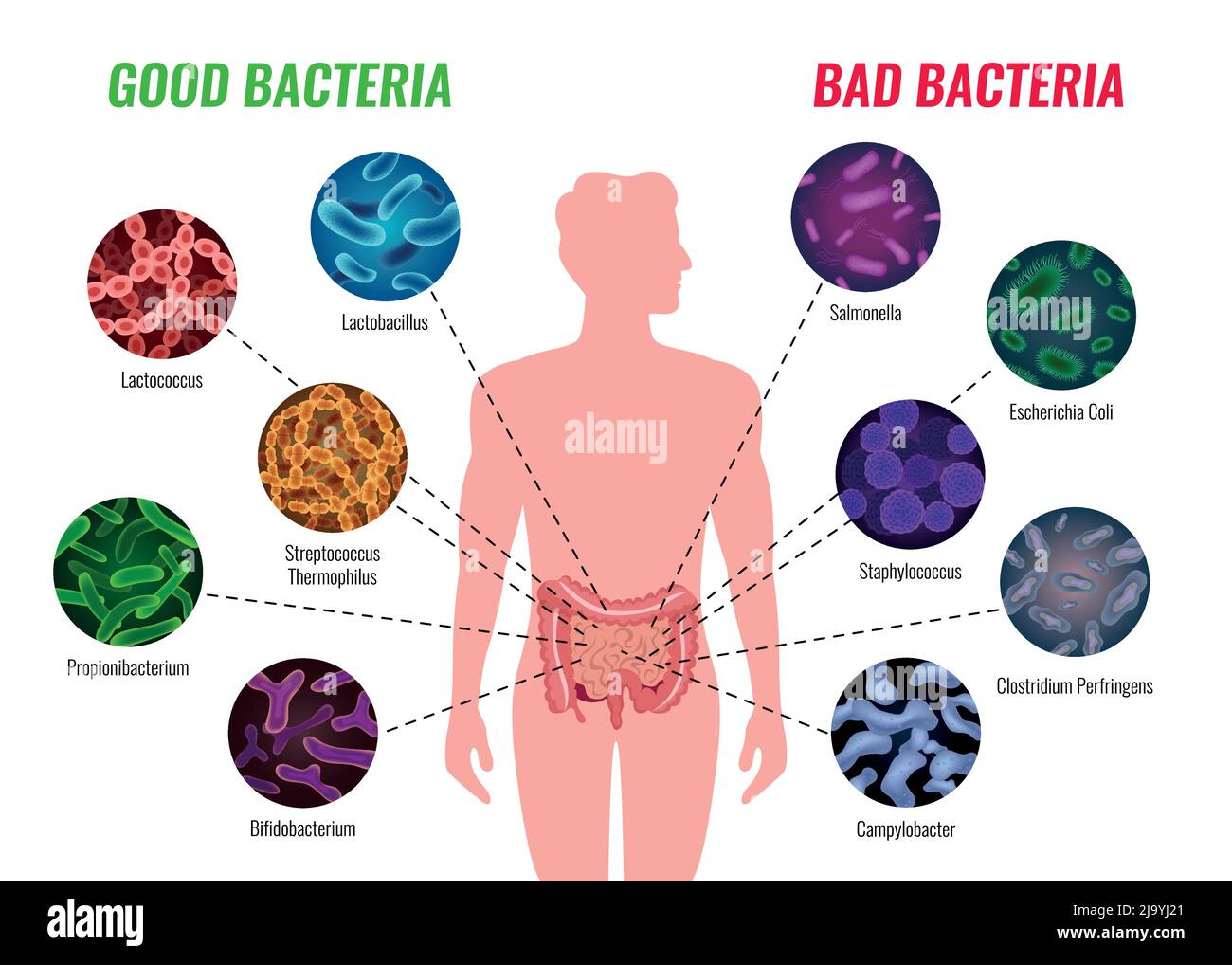 Gutes und schlechtes Bakterienposter mit Gesundheits- und Behandlungssymbolen flache Vektordarstellung Stock Vektor