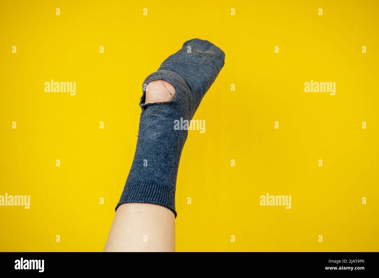 Alte stinkende Socke voller Löcher am Bein auf gelbem Hintergrund Stockfoto