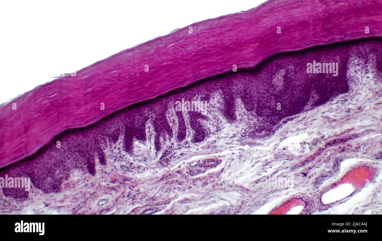 Leichte Mikrographie des epithelialen Gewebes aus der Haut. Menschlicher Fingerschnitt mit Epidermis, Dermis und Bindegewebe. Stockfoto