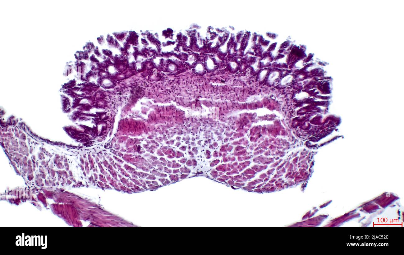 Froschzunge. Zunge und Unterkiefer eines Frosches (Pelophylax ridibundus), Lichtmikroskopie. Hämatoxylin- und Eosin-Färbung. Stockfoto