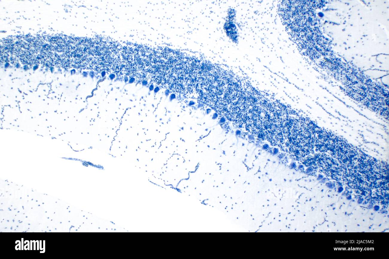 Zerebellum. Purkinje-Zellen. Cresyl-Violette Färbung (Nissl-Färbung). Stockfoto