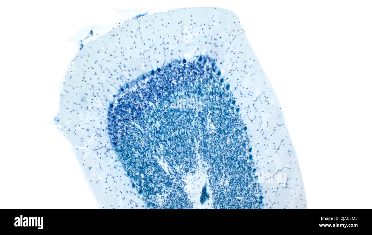 Zerebellum. Purkinje-Zellen. Cresyl-Violette Färbung (Nissl-Färbung). Stockfoto