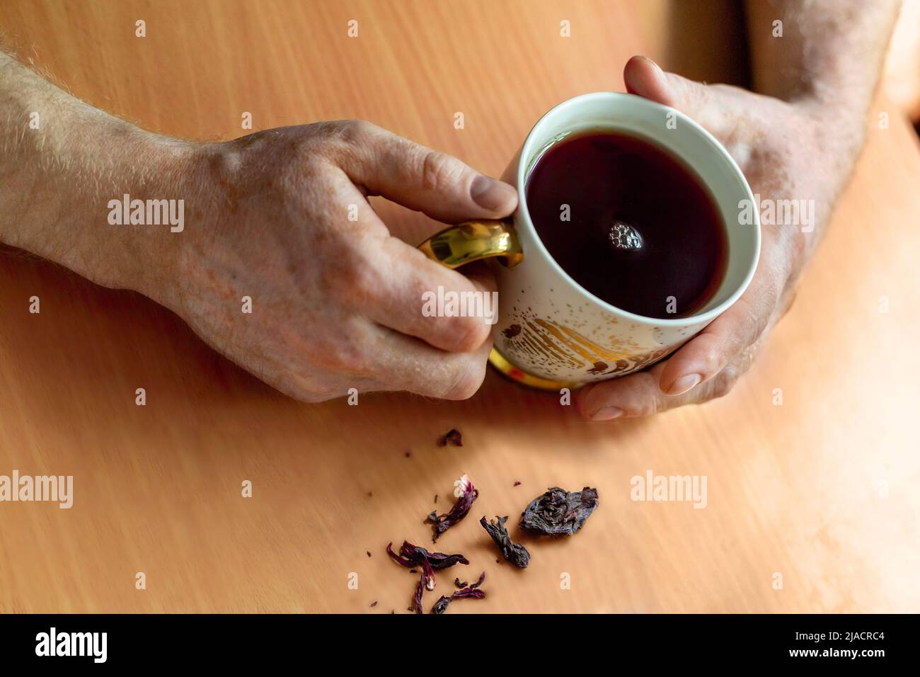 Männliche Hände mit Vitiligo-Verfärbung (fleckiger Verlust der Hautfarbe), halten eine vergoldete Tasse Hibiskus-Tee. Die Teeblätter stehen auf dem Tisch. Stockfoto