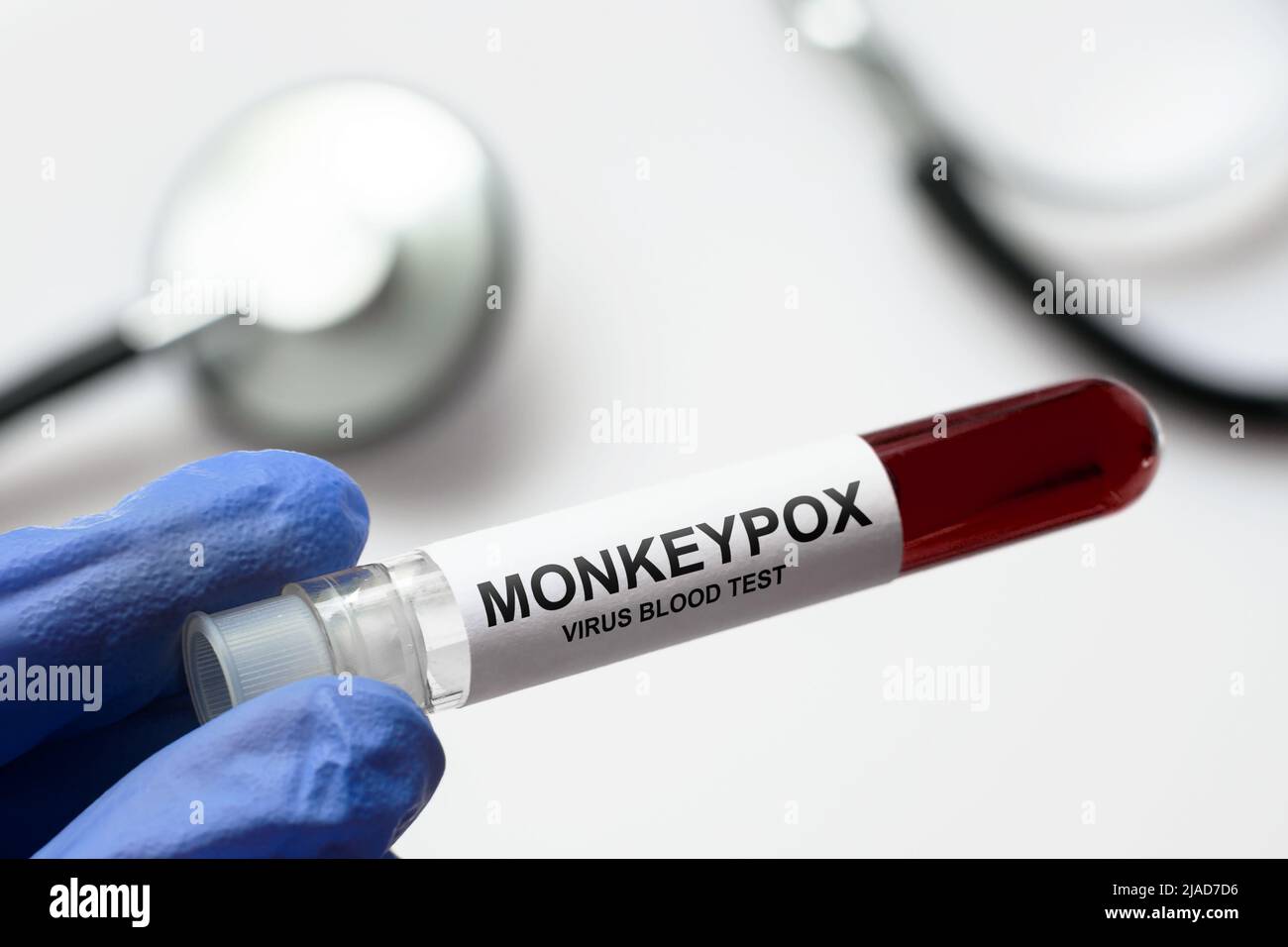 Monkeypox-Teströhrchen in der Hand des Arztes, medizinisches Personal hält Blutprobe für die Pockenvirus-Diagnose und Affenpocken-Forschung. Konzept von monkeypox ou Stockfoto