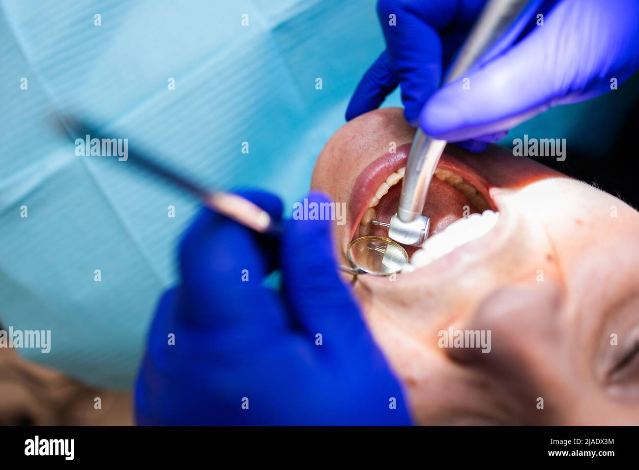 Nicht erkennbarer Zahnarzt, der eine routinemäßige Zahnarztuntersuchung mit einem Bohrwerkzeug macht. Stockfoto