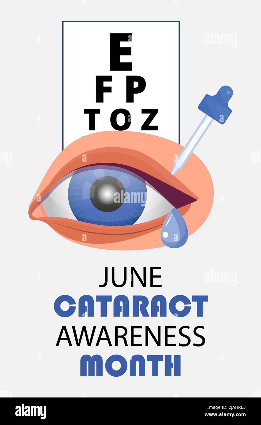 Im Juni wird der Monat des Kataraktbewusstseins gefeiert. Glaukom-Erkrankung und Nephropathie Probleme. Augenarzt, okulistisches Konzept Illustration. Augenlicht che Stock Vektor