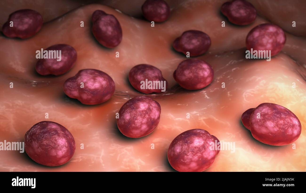 Konzeptionelle biomedizinische Illustration des Malassezia-Fellpilzes auf der Haut. Stockfoto