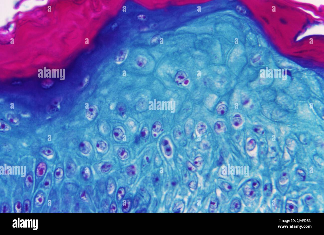 Unter einer Vergrößerung von 125X zeigte dieses Bild einen Abschnitt von Hautgewebe, der von einer Läsion auf der Haut eines Affen gewonnen wurde, die mit dem Monkeypox-Virus infiziert war. Die Probe wurde am 4. Tag der Hautausschlag-Entwicklung gewonnen. Eine optimierte und verbesserte Version eines Bildes, das von den US Centers for Disease Control and Prevention / Credit CDC erstellt wurde Stockfoto Unter einer Vergrößerung von 125X zeigte dieses Bild einen Abschnitt von Hautgewebe, der von einer Läsion auf der Haut eines Affen gewonnen wurde, die mit dem Monkeypox-Virus infiziert war. Die Probe wurde am 4. Tag der Hautausschlag-Entwicklung gewonnen. Eine optimierte und verbesserte Version eines Bildes, das von den US Centers for Disease Control and Prevention / Credit CDC erstellt wurde Stockfoto