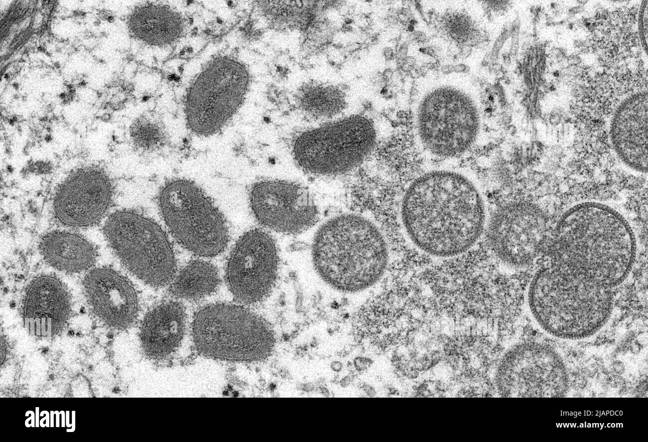 Unter einer Vergrößerung von 125X zeigte dieses Bild einen Abschnitt von Hautgewebe, der von einer Läsion auf der Haut eines Affen gewonnen wurde, die mit dem Monkeypox-Virus infiziert war. Die Probe wurde am 4. Tag der Hautausschlag-Entwicklung gewonnen. Bildnachweis CDC C.S. Goldschmied, R. Regnery 2003. Stockfoto Unter einer Vergrößerung von 125X zeigte dieses Bild einen Abschnitt von Hautgewebe, der von einer Läsion auf der Haut eines Affen gewonnen wurde, die mit dem Monkeypox-Virus infiziert war. Die Probe wurde am 4. Tag der Hautausschlag-Entwicklung gewonnen. Bildnachweis CDC C.S. Goldschmied, R. Regnery 2003. Stockfoto