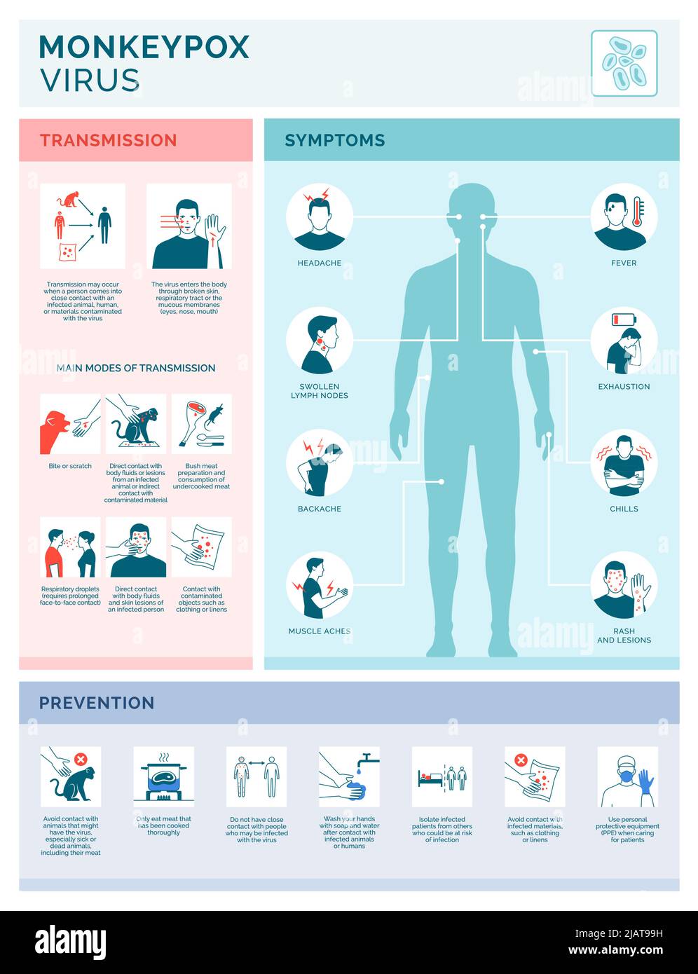 Infografik zur Übertragung des Monkeypox-Virus, zu Symptomen und Präventionsvektoren mit Symbolen Stock Vektor