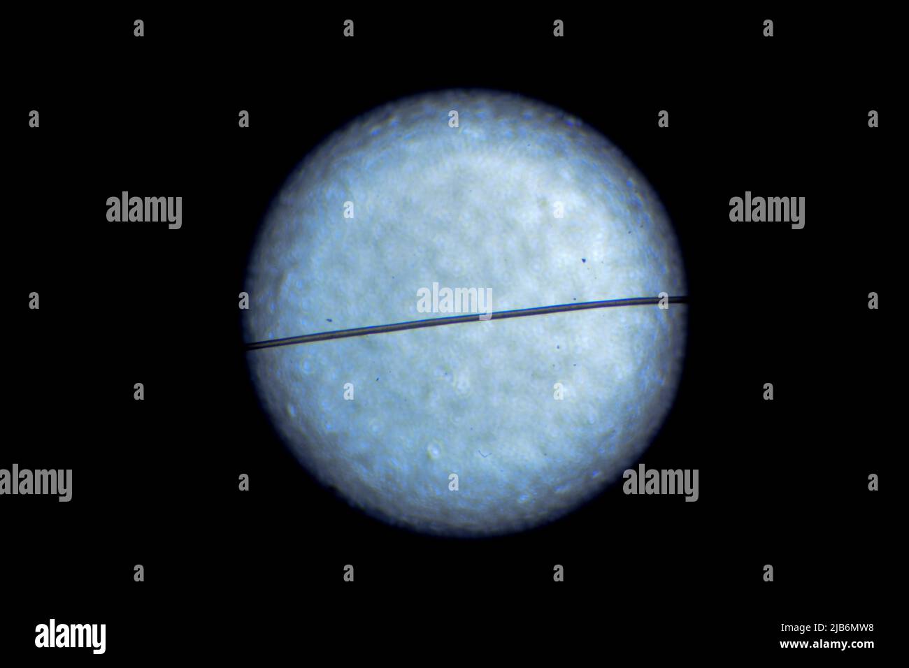 Licht Mikroskop Bild der Haare Stockfoto