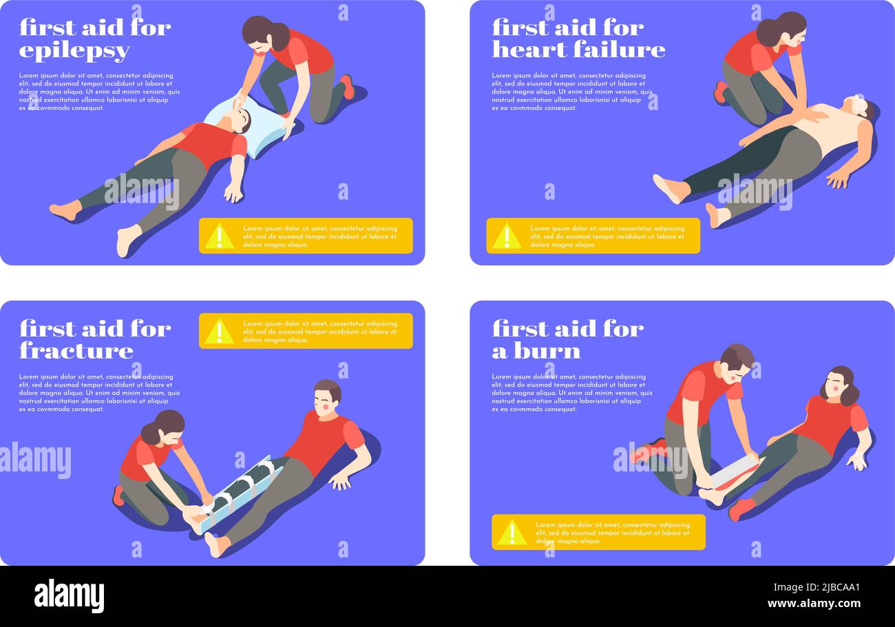 Erste-Hilfe-Behandlungsschritte für Epilepsie Fraktur brennen Herzinsuffizienz 4 isometrische Karteikarten Banner Vektordarstellung Stock Vektor
