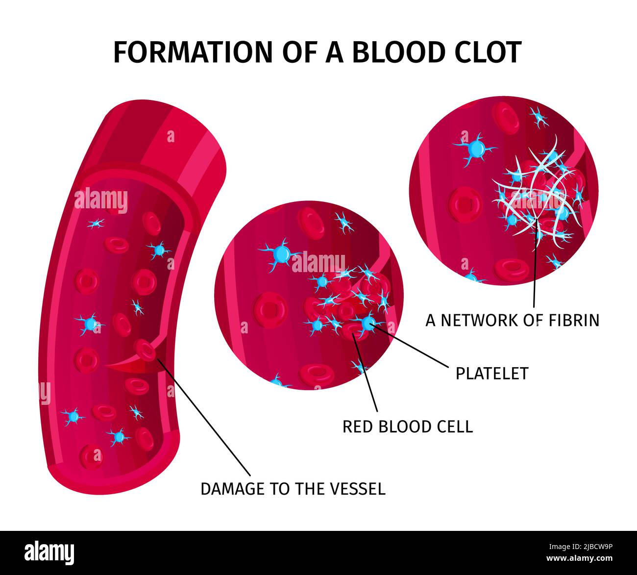 Blutkörperchen Thrombusgerinnung edukative Infografik Bunte Diagramm Darstellung Gerinnungsbildung Prozess Vektor Illustration Stock Vektor