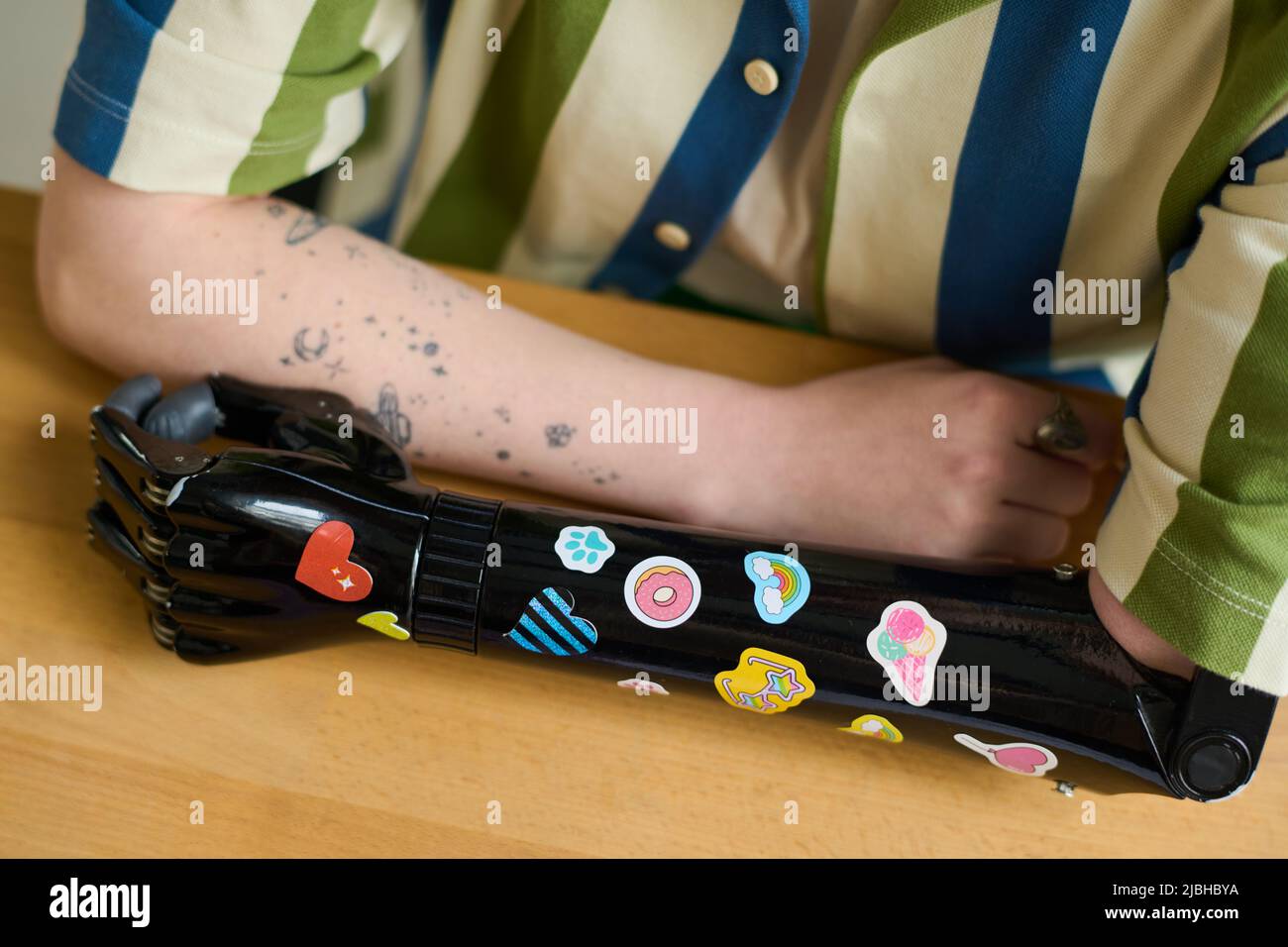 Nahaufnahme der Arme einer jungen Frau mit körperlichen Beeinträchtigungen, deren myoelektrische Prothese mit handgefertigten Stickern verziert wurde Stockfoto