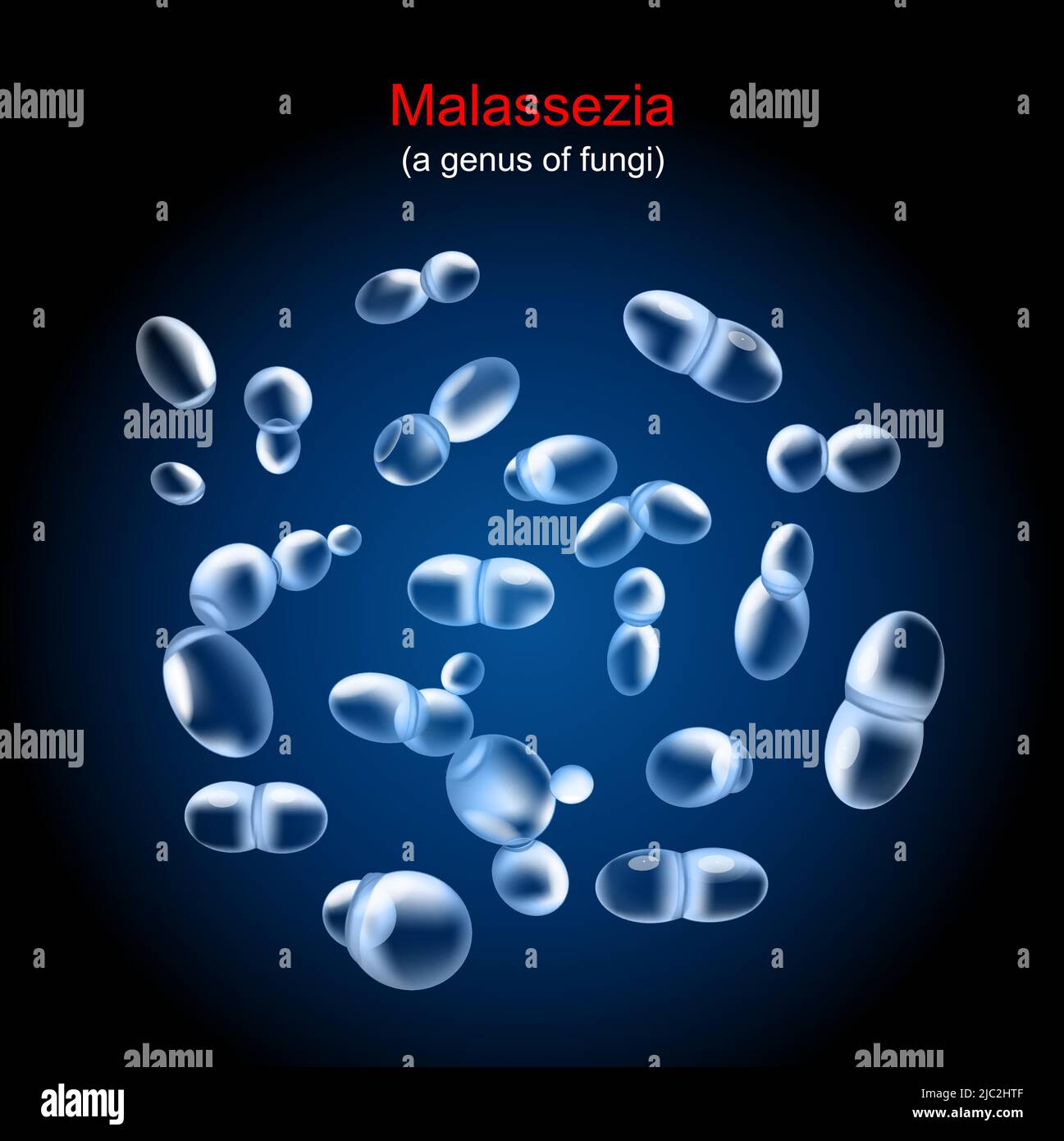 Malassezia. Pilz, der von Tinea versicolor, Pityriasis und anderen Hauterkrankungen verursacht. Nahaufnahme der Hefekolonie auf dunklem Hintergrund. Realistischer Vektor Stock Vektor