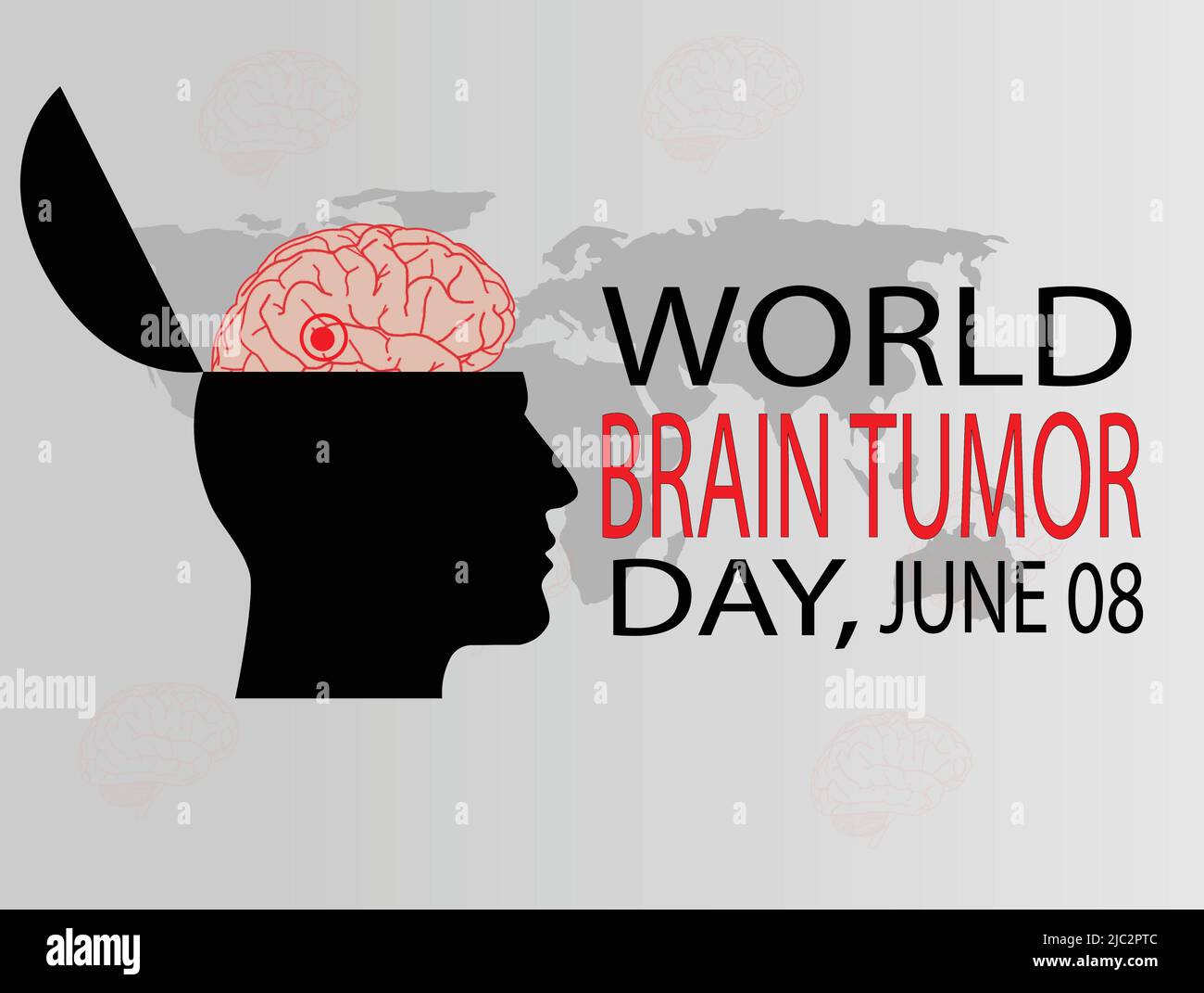 Der Welt-Tumor-Tag des Gehirns wird jedes Jahr am 8.. Juni beobachtet. Es ist ein Überwachstum von Zellen im Gehirn, das Massen bildet, die Tumoren genannt werden. Vektordarstellung Stock Vektor