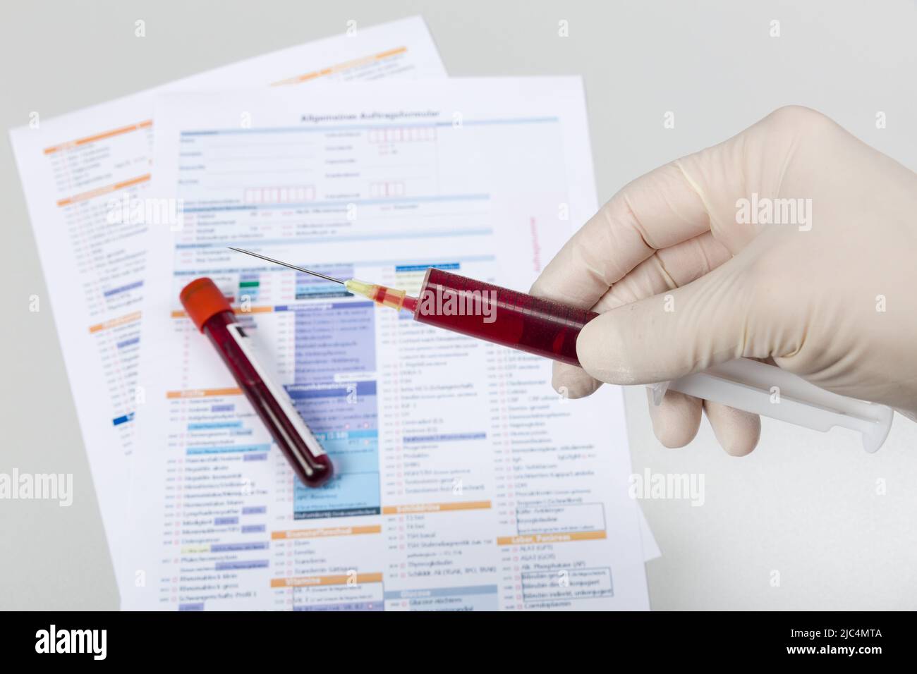 Hand in medizinischen Handschuhen hält eine Spritze mit Blut vor einem Antragsformular für die Analyse in einem Labor Stockfoto