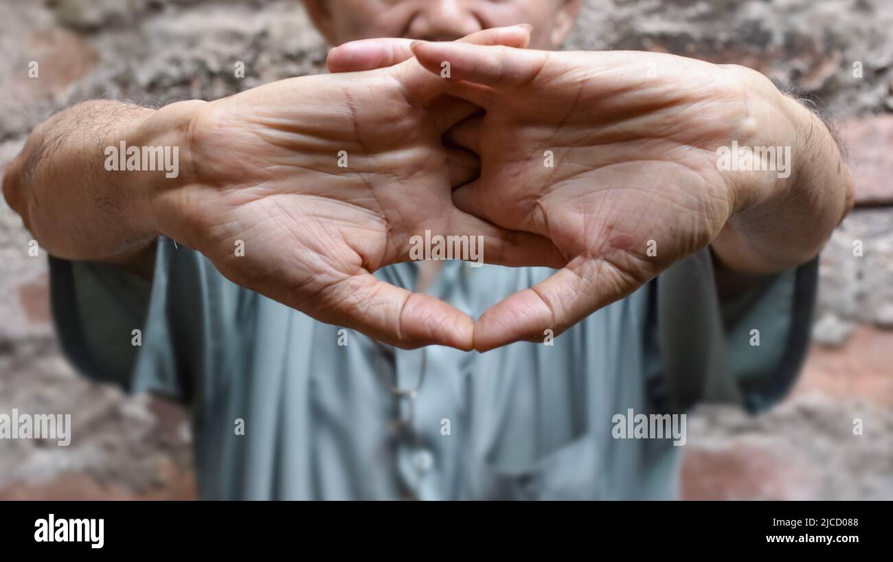 Stärkung der Armmuskulatur des asiatischen älteren männlichen Patienten mit Muskelkrämpfen. Stockfoto