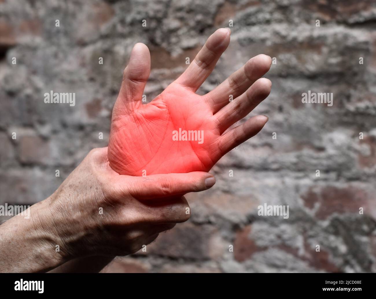 Schmerzhafter Palmaraspekt des asiatischen alten Mannes. Konzept des Kompartiment-Syndroms, Zellulitis und Schmerzen der Handmuskulatur. Stockfoto