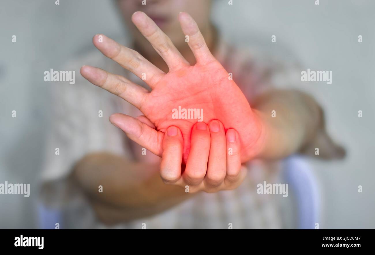 Schmerzhafter Palmar-Aspekt des asiatischen jungen Mannes. Konzept des Kompartiment-Syndroms, Zellulitis und Schmerzen der Handmuskulatur. Stockfoto