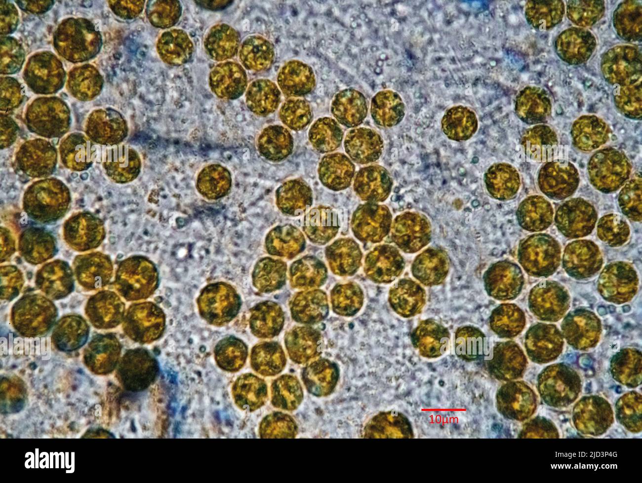 Symbiotische Algen (Zooxanthellae) aus Aiptasia sp., wahrscheinlich aus dem Bereich Breviolum dendrogyrum. Die einzelnen Zellen sind im Durchschnitt etwa Stockfoto
