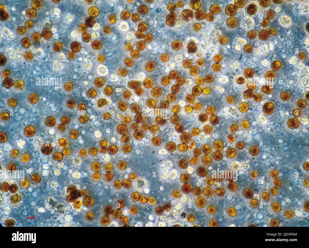 Zooxanthellae aus einer weichen Koralle (wahrscheinlich Sinularia sp.). Die einzelnen Zellen haben einen Durchmesser von 10-12 µm. Stockfoto