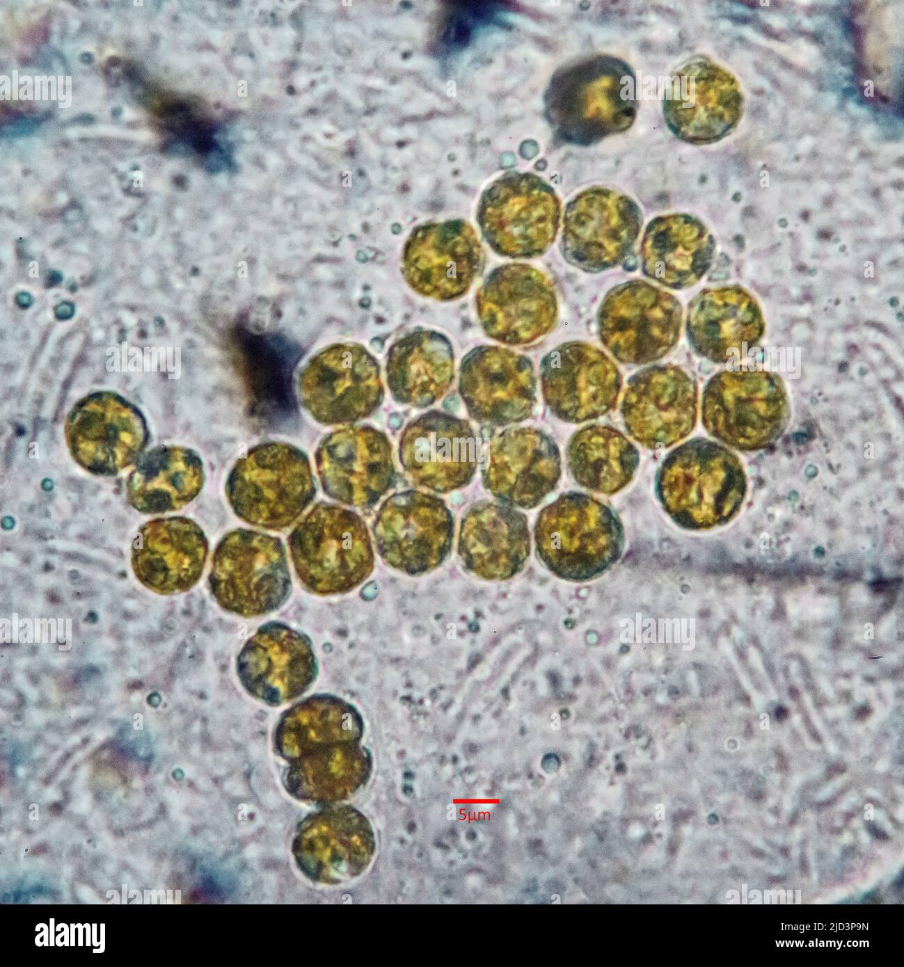 Symbiotische Algen (Zooxanthellae) aus Aiptasia sp., wahrscheinlich aus dem Bereich Breviolum dendrogyrum. Die einzelnen Zellen sind im Durchschnitt etwa Stockfoto