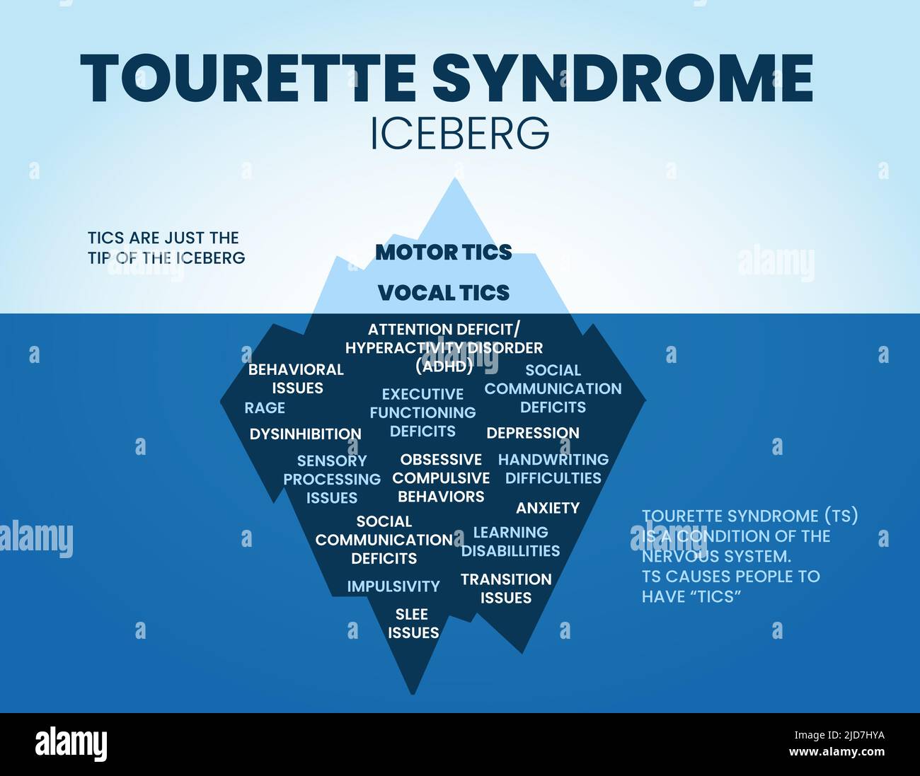 Der Vektor des Tourette-Syndroms Eisberg hat seine motorischen und vokalen Tics auf der Oberfläche und verbirgt die Lebensbedingungen oder Ursachen der Tic unter Wasser. Der Stock Vektor