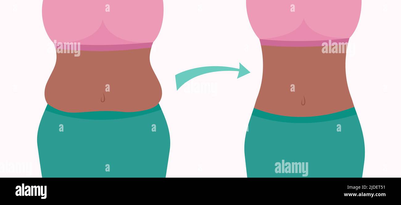 Gewichtsverlust Erfolg vor und nach. Fett und schlank Körper des Mädchens. Übergewichtige afroamerikanische Frau, Gewicht zu verlieren in der Taille. Flache Vektorgrafik. Stock Vektor