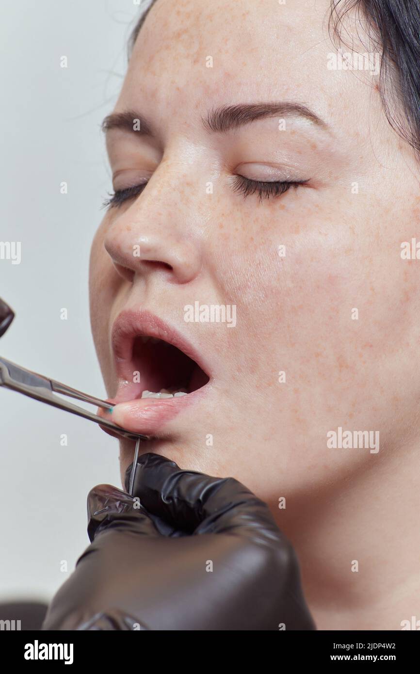 Stich in die zunge Fotos und Bildmaterial in hoher Auflösung Alamy