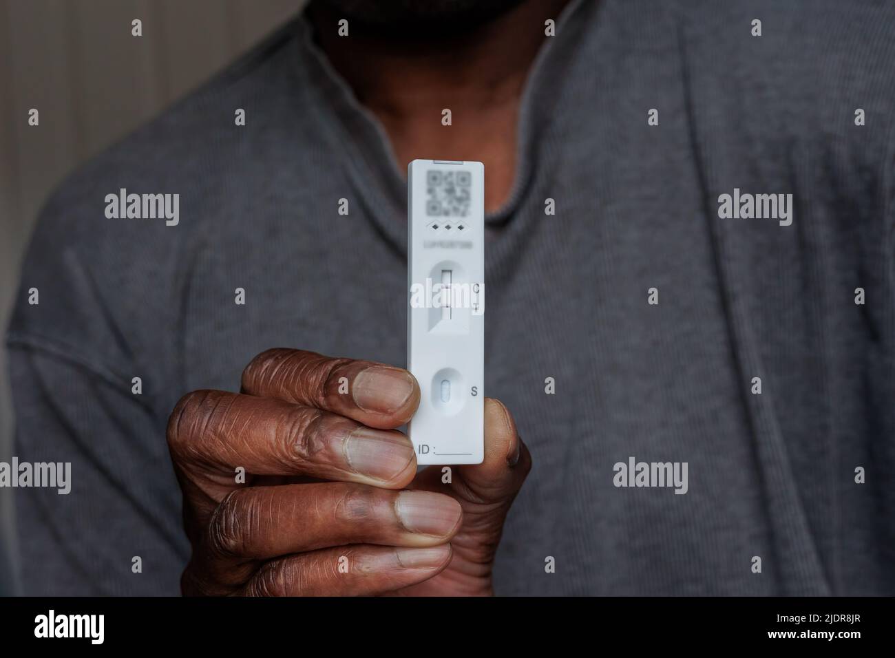 Person mit afrikanischer Ethnie, die einen einzigen positiven Covid-19-Schnelltest mit lateralem Flussantigen durchgeführt hat Stockfoto