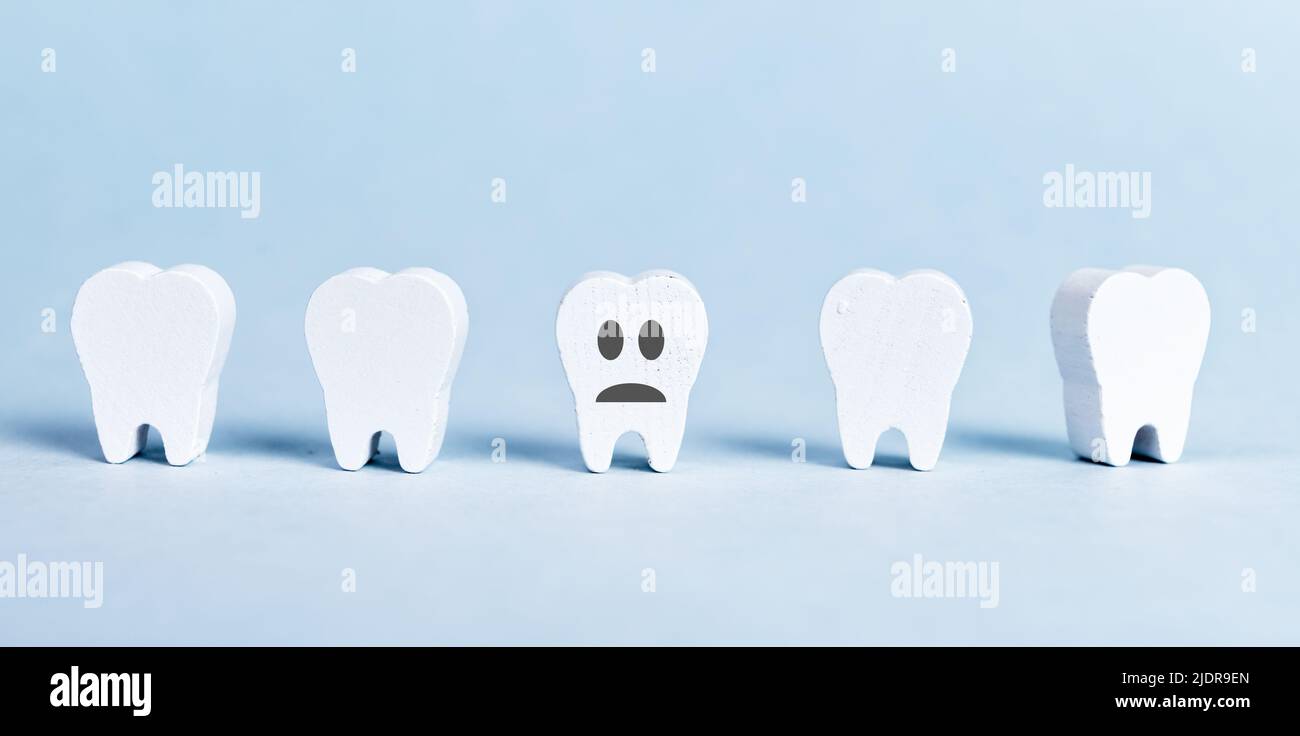 Weiße Zähne Reihen sich und eine mit trauriger Emoji. Schlechte Mundhygiene, Zahnprobleme, Parodontitis, Karies Konzept. Zahn auf blauem Hintergrund. Hochwertige Fotos Stockfoto
