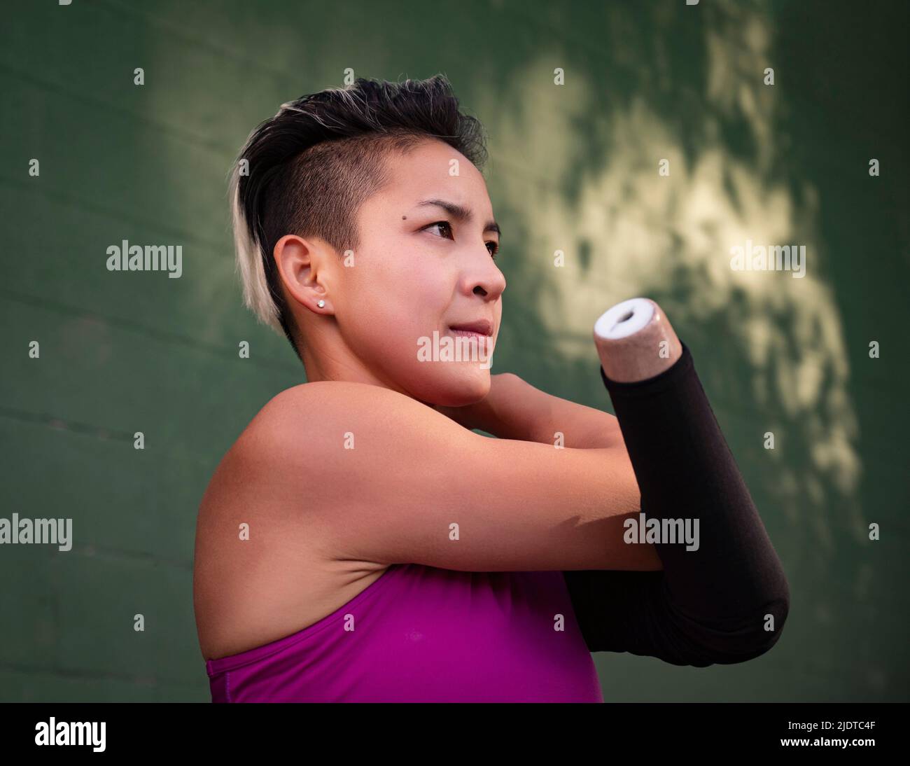 Sportlerin mit amputiertem Arm Stockfoto