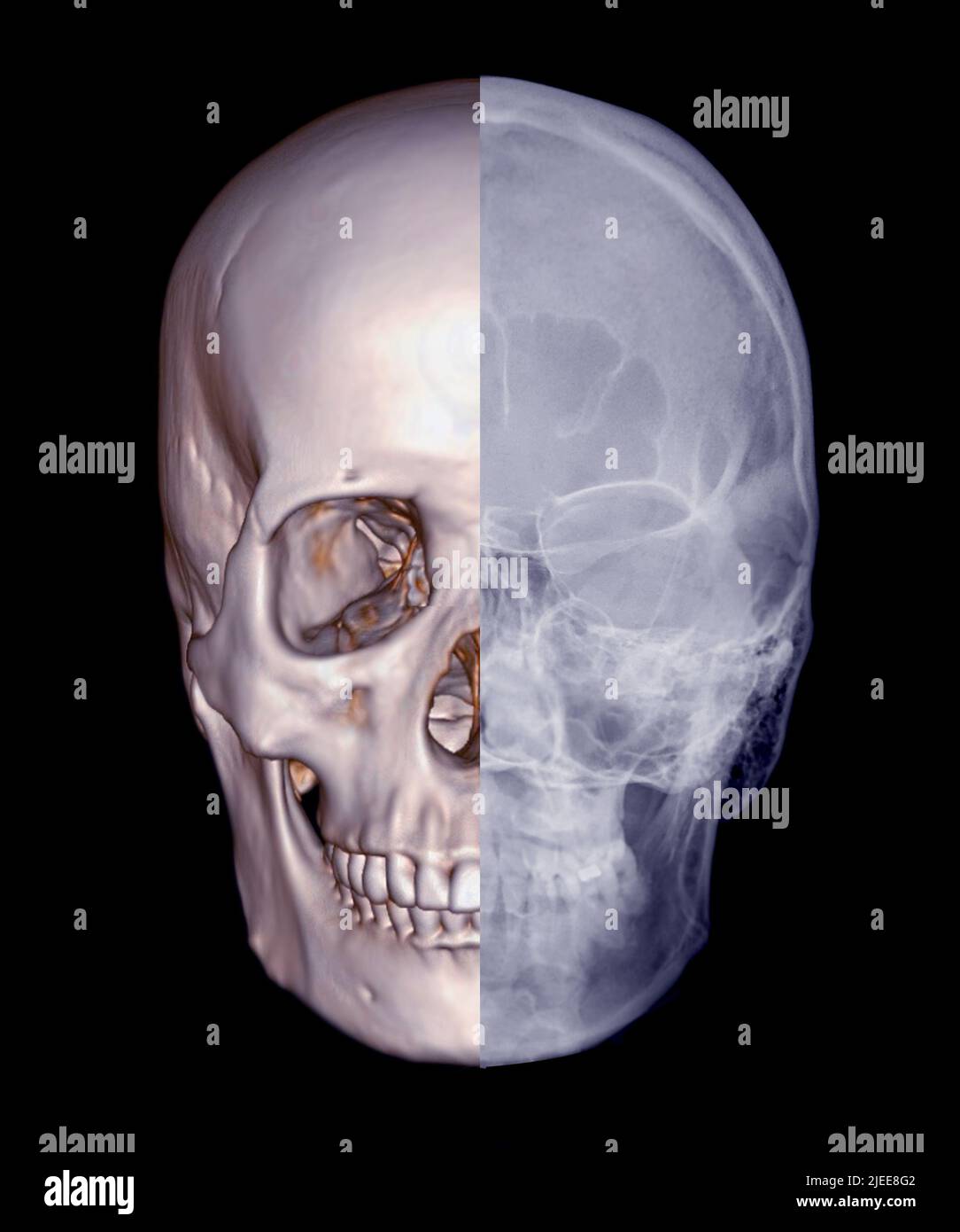 Schädel 3D aus CT Scan von Gesichtsknochen 3D Rendering mit Schädelxray showng menschlichen Schädel Stockfoto