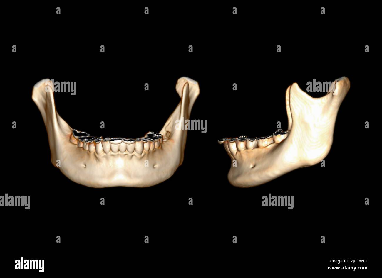 CT-SCAN des Unterkieferknochens 3D, das ein auf schwarzem Hintergrund isoliertes Renderbild darstellt. Beschneidungspfad Stockfoto