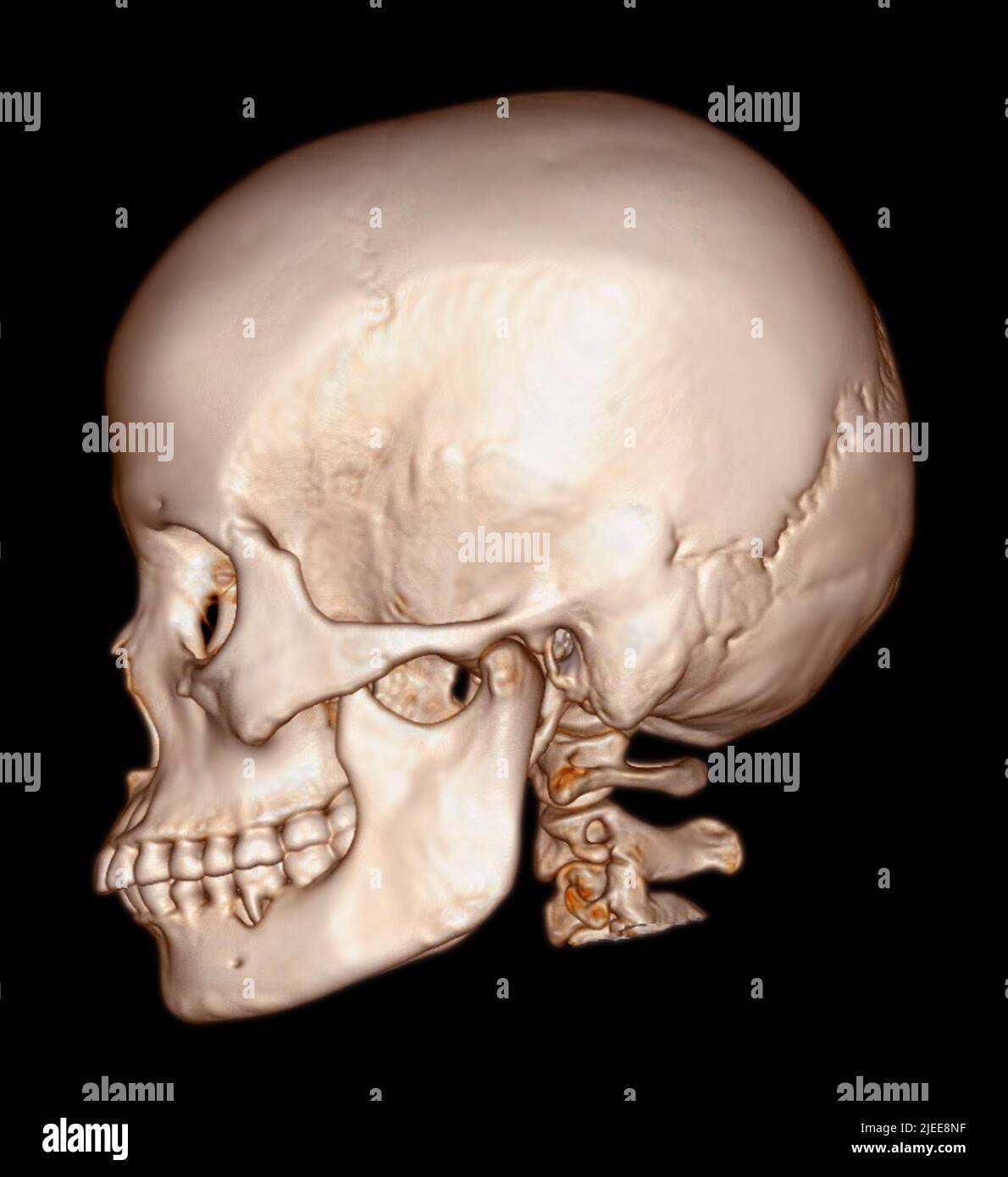 Schädel 3D aus CT Scan von Gesichtsknochen 3D, der einen schemenig menschlichen Schädel darstellt Stockfoto