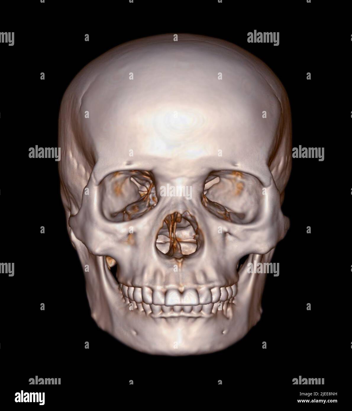 Schädel 3D aus CT Scan von Gesichtsknochen 3D, der einen schemenig menschlichen Schädel darstellt Stockfoto