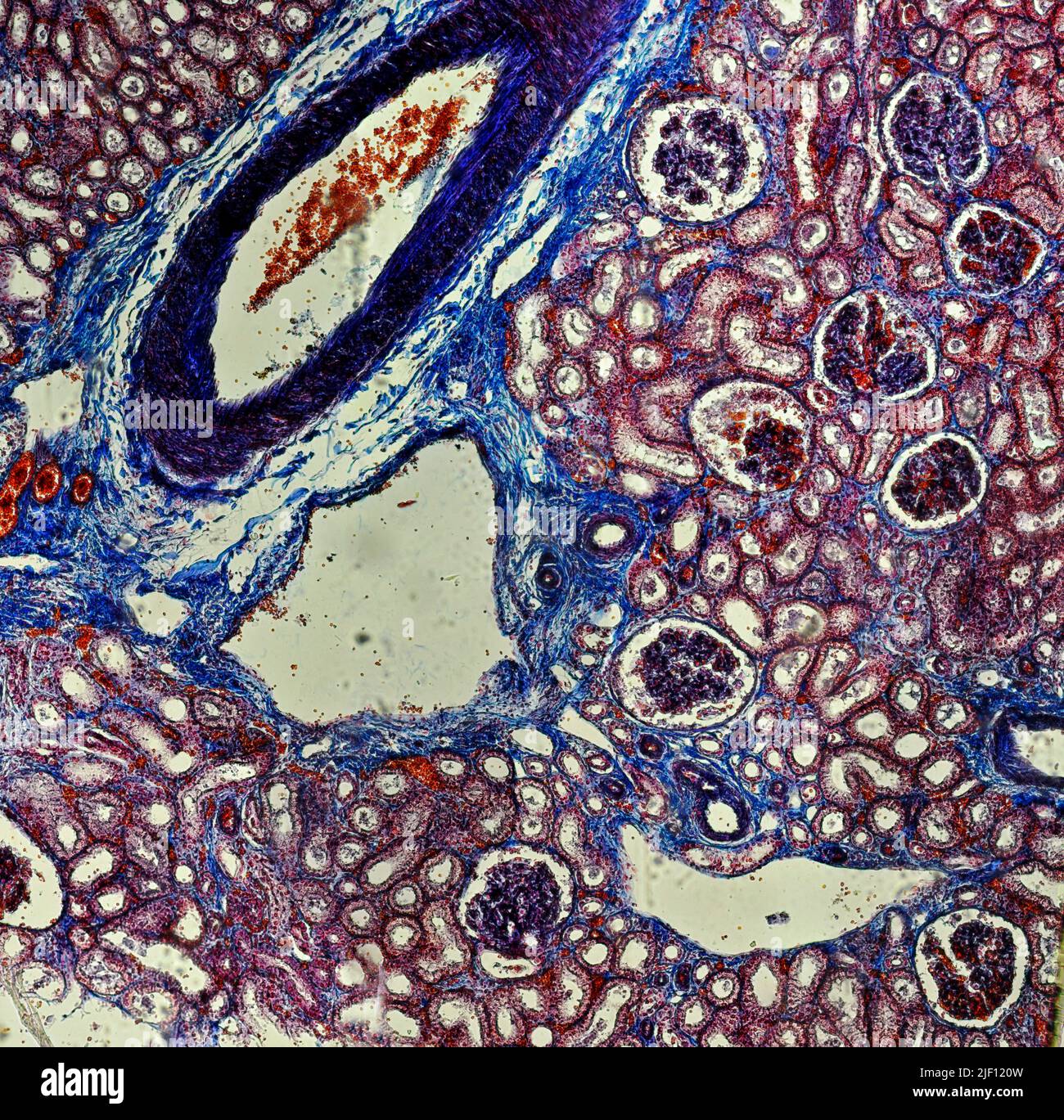 Querschnitt einer Niere mit mehreren Glomerolus sichtbar. Stockfoto